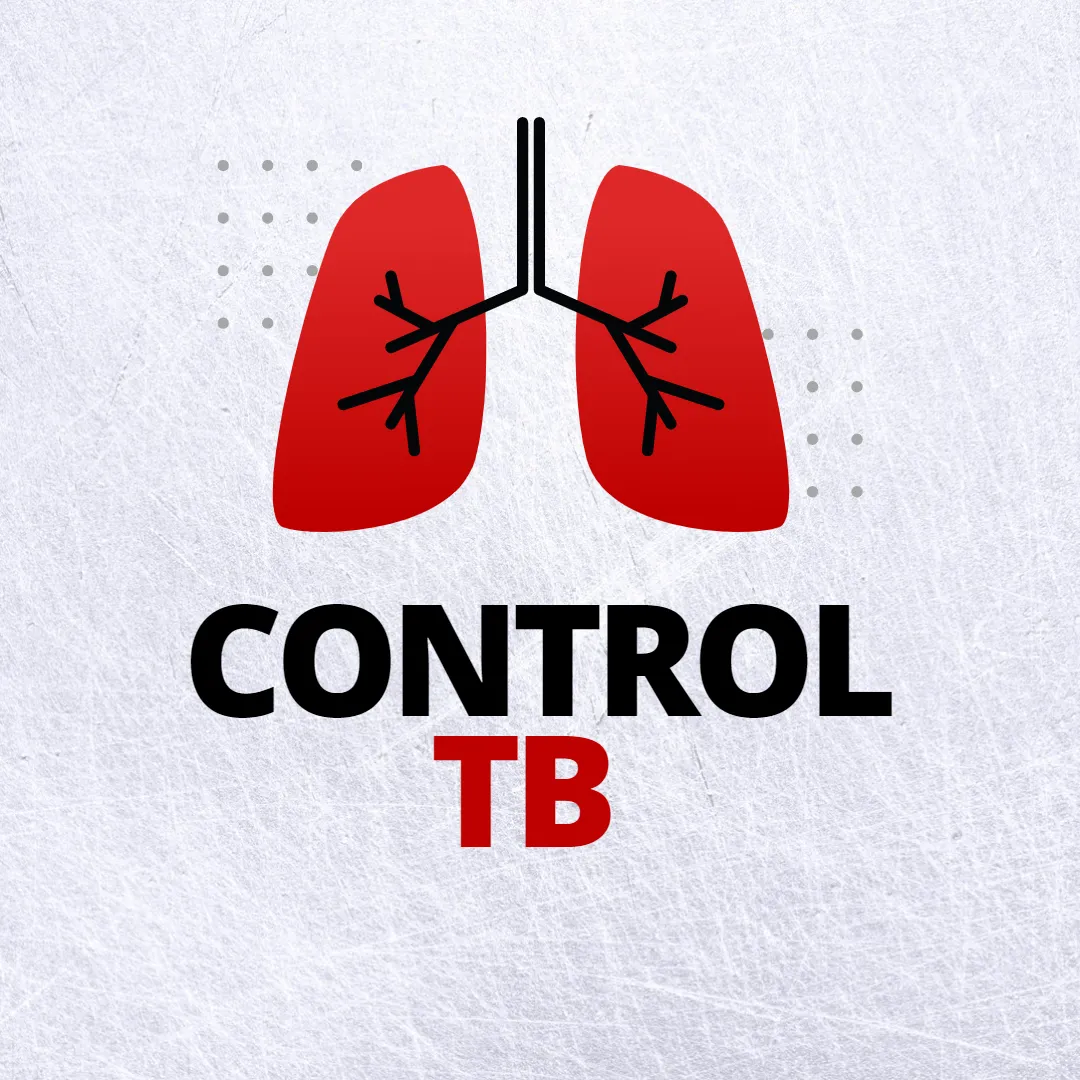 Control TB