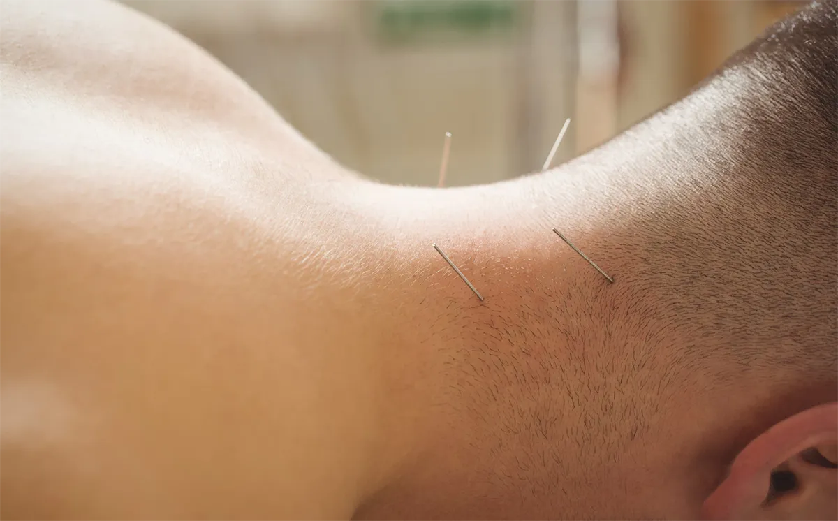 Acupuncture Research Studies